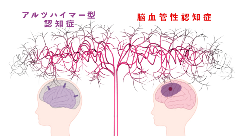 脳 の 血 流 漢方